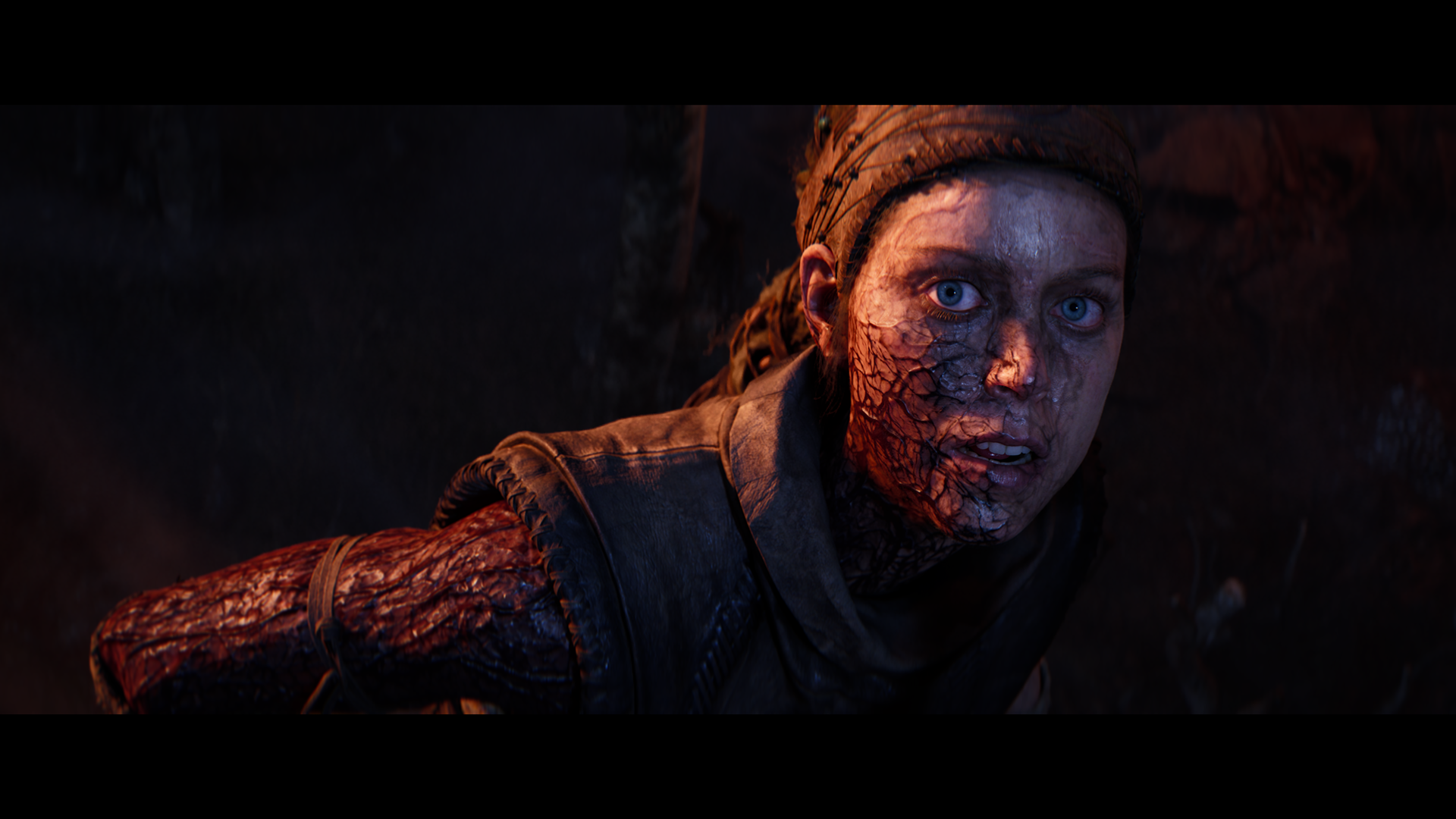 Senua is infected with the dark rot